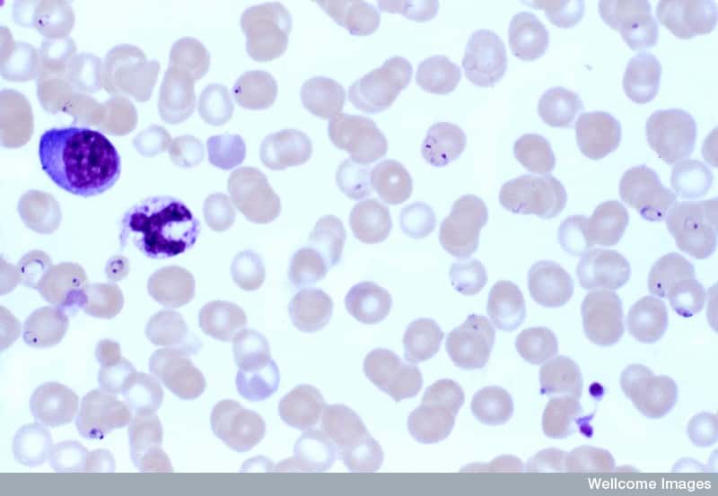 Un frottis sanguin montre la présence de <em>Plasmodium</em>, le responsable du paludisme, dans des globules rouges. Le parasite est transmis à l'Homme lors de la piqûre par un moustique. © Spike Walker, Wellcome Images, Flickr, cc by nc nd 2.0