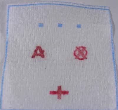 Voici un exemple de ce que le papier affiche. Ici, l'échantillon sanguin appartient à une personne A+. Le O est barré d'une croix. © <em>Monach University</em>