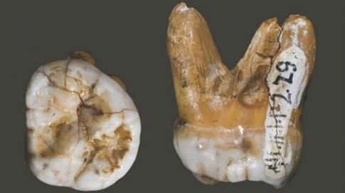 Cette molaire a été retrouvée dans la grotte de Denisova, en Sibérie. Elle aurait appartenu à une petite fille dénisovienne ayant vécu voici 38.500 à 42.000 ans. Les chercheurs ont pu en extraire de l'ADN pour séquencer le génome complet de cette espèce proche d'<em>Homo neanderthalensis</em>. © David Reich <em>et al.</em> 2010, <em>Nature</em>
