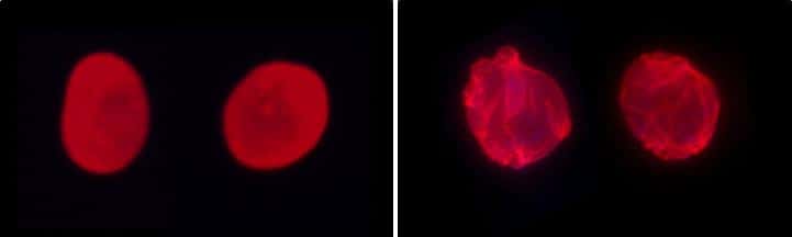 À gauche, des cellules saines ; à droite, des cellules atteintes par la progéria. Pour chacune d'entre elles, la lamine A a été marquée en rouge. La protéine n'est pas du tout organisée de la même façon. © Xavier Nissan, I-Stem