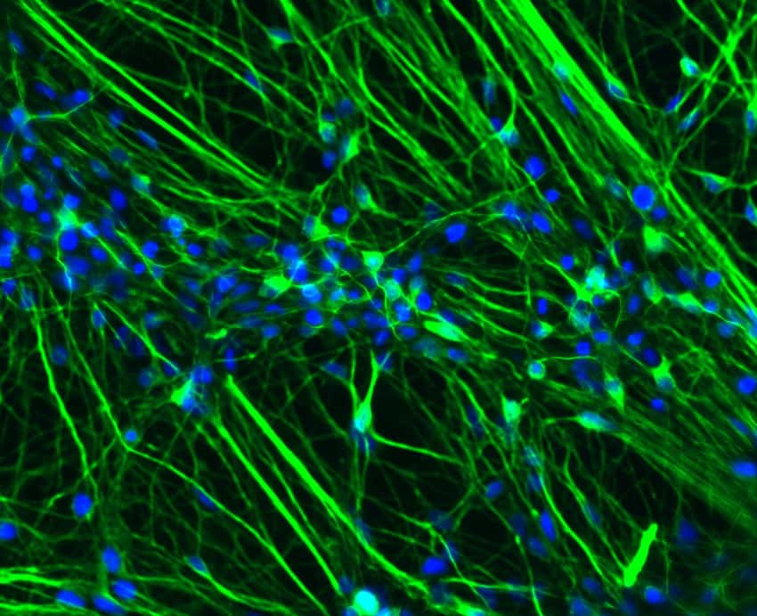 Ces neurones sont issus de malades atteints de la progéria. En bleu figure l'ADN, une protéine spécifique des neurones en vert, et la lamine A est marquée en rouge. Elle est ici absente. © Xavier Nissan, I-Stem