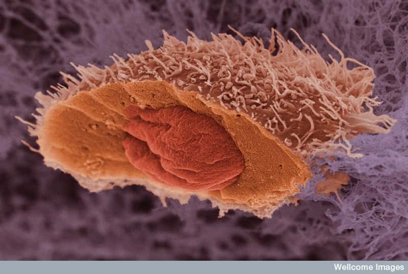 Les cellules tumorales possèdent des mutations dans leur ADN qu'on ne retrouve pas dans les cellules saines. Grâce aux progrès des techniques de génomique, on peut les détecter dans le sang. © Anne Weston, Wellcome Images, Flickr, cc by nc nd 2.0
