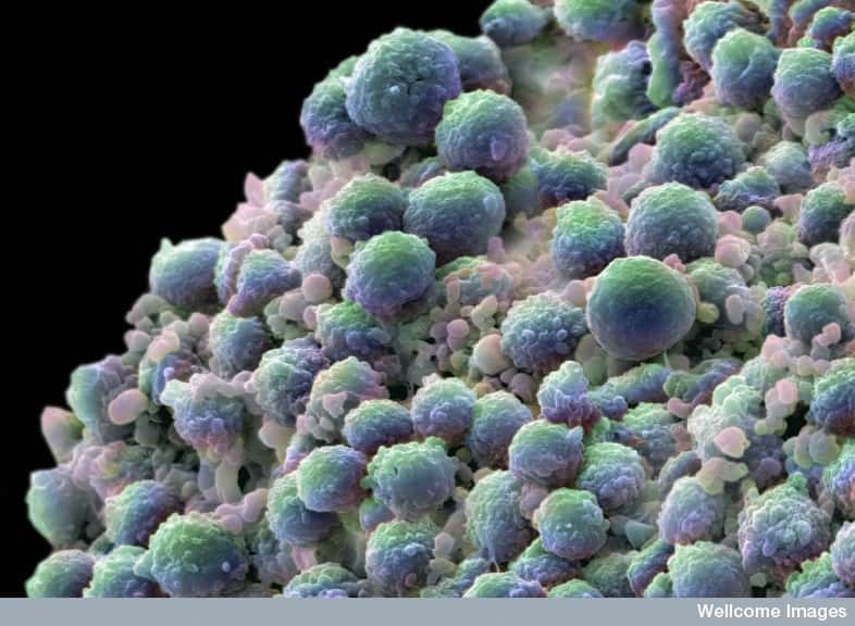 Il y a les mutations dans les cellules tumorales, mais aussi tout ce qu'on trouve autour. Le microenvironnement est un terme large qui regroupe plusieurs aspects, comme les paramètres immunologiques ou angiogéniques. © Annie Cavanagh, Wellcome Images, Flickr, cc by nc nd 2.0