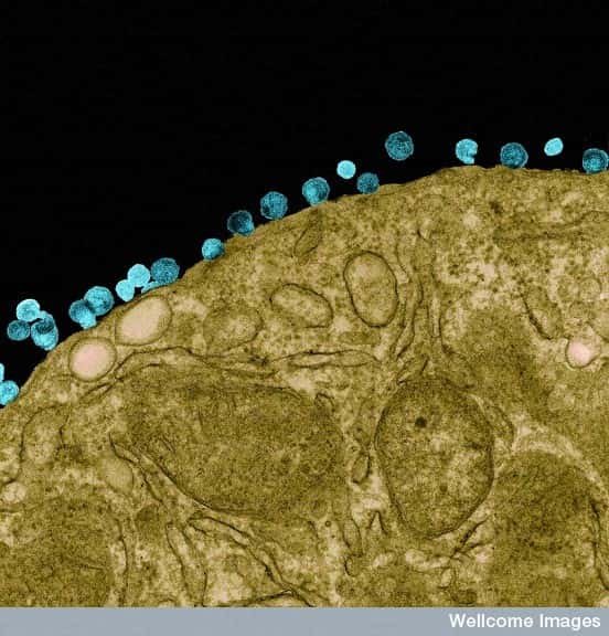 Les trithérapies n'éliminent pas complètement le VIH, que l'on voit à l'image, représenté par ces petits disques bleus à la surface d'un lymphocyte. Le virus du Sida se réfugie dans certaines cellules, entre en phase de latence et attend son heure. Si l'on arrête les traitements antirétroviraux, le VIH se manifeste de nouveau. © R. Dourmashkin, Wellcome Images, Flickr, cc by nc nd 2.0