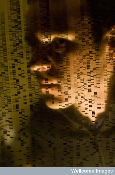 Le génome de nos ancêtres est presque identique au nôtre, et l’on peut facilement différencier l'ADN des Hommes de celui des bactéries à l'aide de sondes adaptées. © David Nelson, Wellcome Images, Flickr, cc by nc nd 2.0