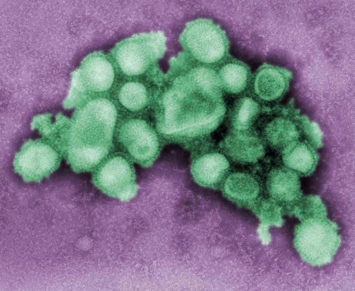 La nouvelle souche A (H3N2v) possède le gène M, qui se retrouve également dans le virus A (H1N1) que l'on voit à l'image. © S. Goldsmith and A. Balish, CDC, DP 