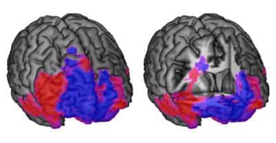En bleu figurent les régions du lobe frontal spécialisées dans la prise de décision, le rouge se réfère au contrôle comportemental. Le cerveau de gauche est complet, tandis qu'une section vient entailler le cerveau de droite pour voir ce qu'il se passe en dessous la surface. © <em>California Institute of Technology</em>