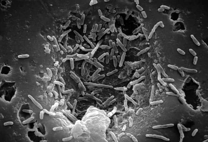 <em>Mycobacterium chelonae</em>, ici vue au microscope électronique à balayage, n'est pas une bactérie très pathogène et cause très rarement des infections. Mais lorsqu'elle est directement injectée sous la peau, le travail lui est facilité... © Janice Haney Carr, CDC, DP
