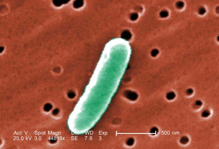 Les bactéries intestinales, comme cette <em>Escherichia coli</em> ou d'autres espèces, se mettent parfois à coloniser l'appendice et à causer une inflammation très douloureuse. © Janice Haney Carr, CDC, DP