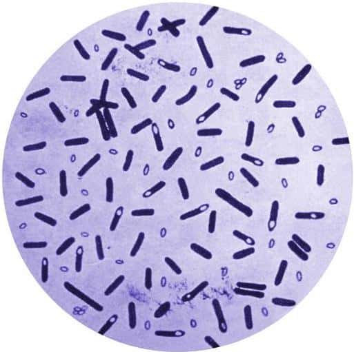 <em>Clostridium botulinum</em> est la bactérie qui produit la toxine botulique, l'une des plus puissantes au monde. En inhibant le relargage d'acétylcholine au niveau nerveux, l'information ne peut parvenir jusqu'aux muscles qui se trouvent paralysés. © CDC, DP