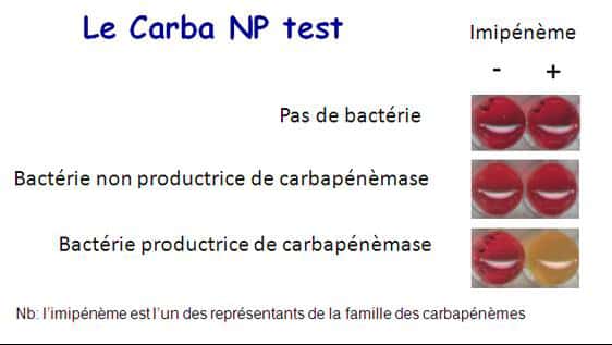 Voici le principe de fonctionnement d'un des deux tests : le Carba NP test. Les bactéries résistantes, celles qui synthétisent l'enzyme capable de rester insensible au carbapénème, prennent une couleur orangée à cause de l'acidification du milieu que cela provoque quand, sans résistance la boîte de Pétri reste rouge. © Patrice Nordmann, Inserm