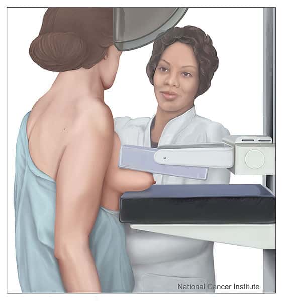 La mammographie est une technique de radiographie qui vise à détecter les tumeurs. Elle serait moins fiable pour les femmes trentenaires que l'échographie mammaire, qui utilise des ondes sonores au lieu de rayons X. © <em>National Cancer Institute</em>, Wikipédia, DP