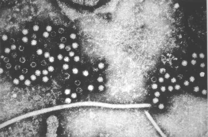 Le virus de l'hépatite E, ici vu au microscope électronique, est connu depuis plus d'un demi-siècle maintenant, et le premier traitement luttant contre l'infection vient d'être mis sur le marché. Le vaccin Hecolin réduira-t-il drastiquement le nombre de victimes de la maladie ? © CDC, DP