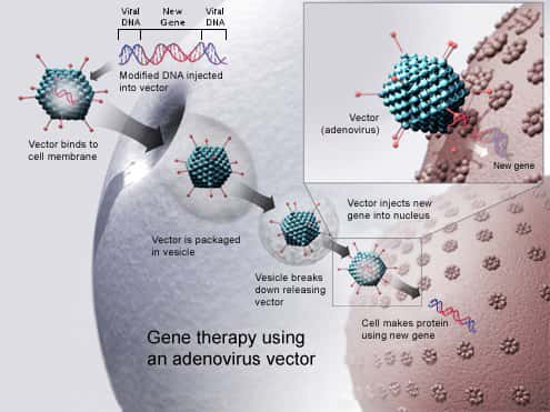Ce schéma explique le principe de la thérapie génique. Un virus vecteur contenant un gène sain (<em>new gene</em>) pénètre la cellule par la membrane plasmique (<em>vector binds to cell membrane</em>) avant d'atteindre le noyau. Là il insère son génome qui va être lu et transformé en protéine fonctionnelle (<em>cell make protein using new gene</em>). Dans ce cas, c'est la lipoprotéine lipase. © NIH, Wikipédia, DP