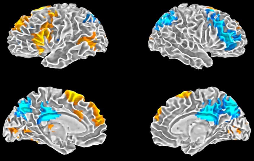 Ces schémas montrent les résultats obtenus par les chercheurs. En orange on peut voir les régions du cerveau qui s'activent au moment de l'improvisation, telles le cortex préfrontal médian. En bleu, ce sont les régions qui perdent en activité dans ce même contexte, dont le cortex préfrontal dorsolatéral. © <em>Scientific Reports</em>