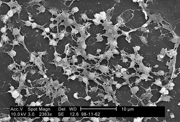 Les biofilms ne sont pas que l'œuvre de bactéries, comme ici le staphylocoque doré. Algues et champignons unicellulaires en sont également capables. © Janice Carr, CDC, DP