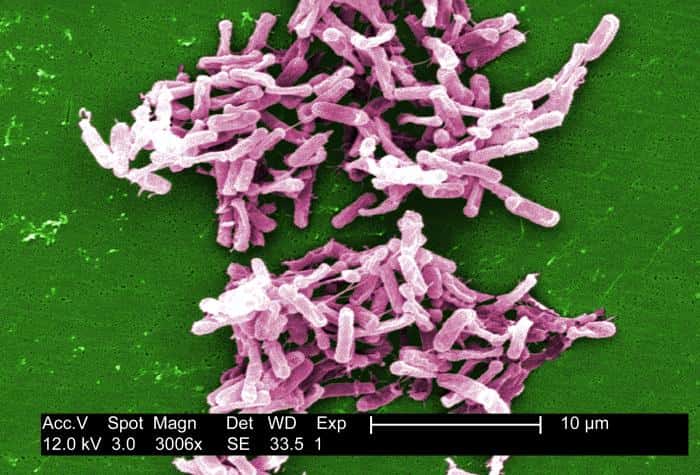 <em>Clostridium difficile</em> est une bactérie retrouvée fréquemment dans la flore intestinale humaine, sans engendrer la moindre pathologie. Cependant, quand le terrain lui est favorable, elle sécrète des toxines qui rendent difficile la digestion. Aux États-Unis, cette infection devient de plus en plus courante et surtout de plus en plus mortelle. © Janice H. Carr, CDC, DP