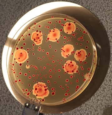 Colonies provenant d'une souche hypermutatrice d'<em>Escherichia coli</em>. Près de 171 clones bactériens ont été étudiés depuis 1988.  © UJF