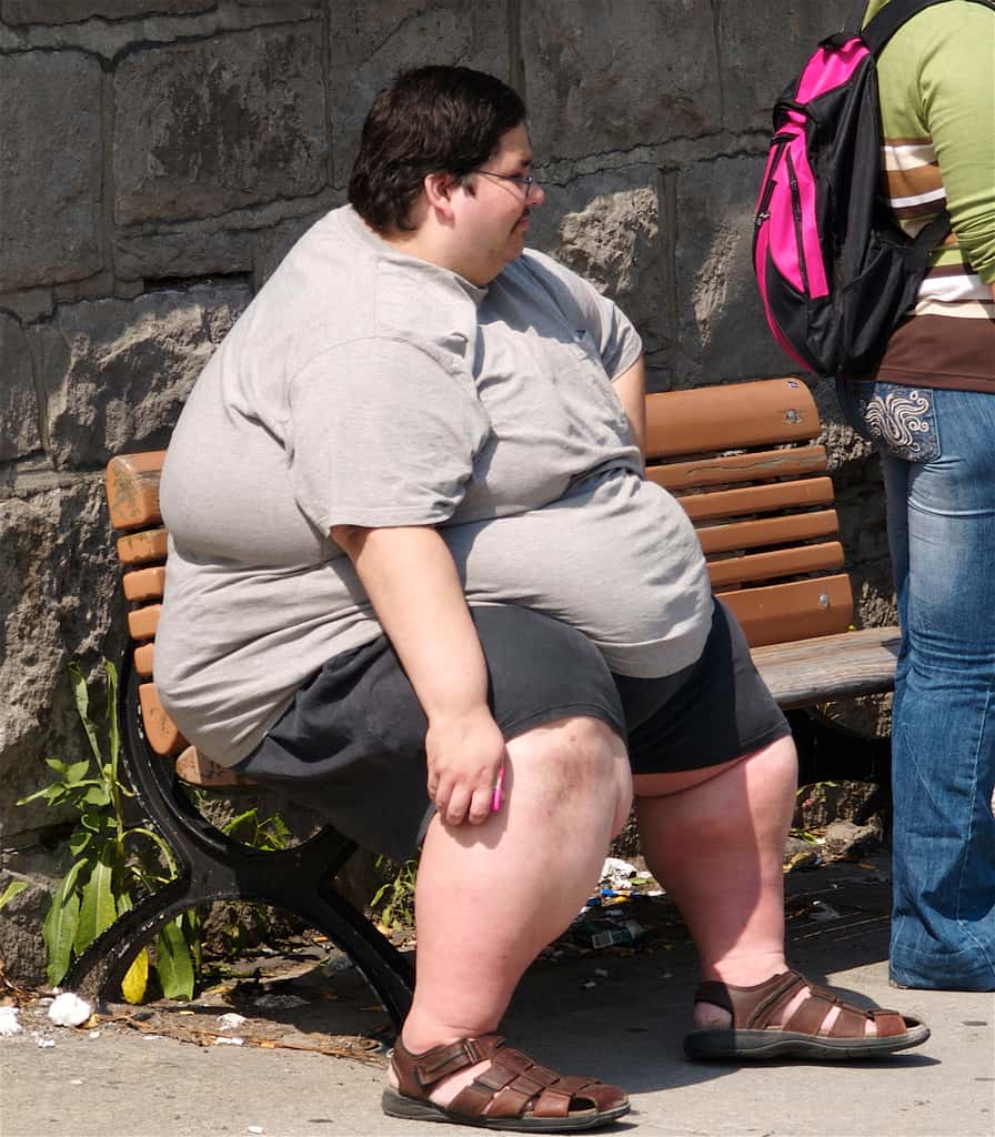 L'obésité s'accompagne d'autres troubles de la santé, comme le diabète de type 2 ou l'hypercholestérolémie. Le glycane LNFP III pourrait atténuer ces symptômes consécutifs au surpoids. © colros, Flickr, cc by 2.0
