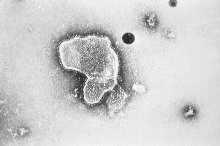 Le virus respiratoire syncytial (VRS), ici vu en microscopie électronique, est le principal responsable de la bronchiolite et des pneumonies chez les enfants de moins d'un an. Il ne mesure pas plus de 300 nm et a une forme variable. © E. L. Palmer, CDC, DP