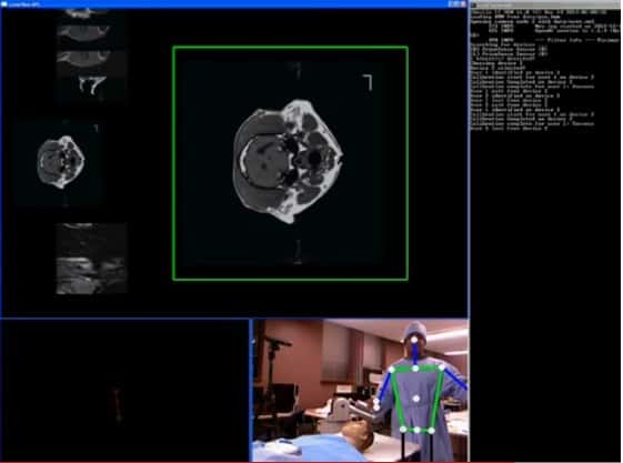 Dans cette simulation réalisée par les chercheurs de l’université Purdue, on peut voir comment un chirurgien manipule des IRM par les gestes de sa main gauche. On aperçoit le capteur Kinect dans le coin supérieur gauche de la fenêtre en bas au centre de l’écran. L’algorithme interprète la nature des gestes et déduit s’il s’agit ou non d’une commande pour manipuler une image. © Université Purdue