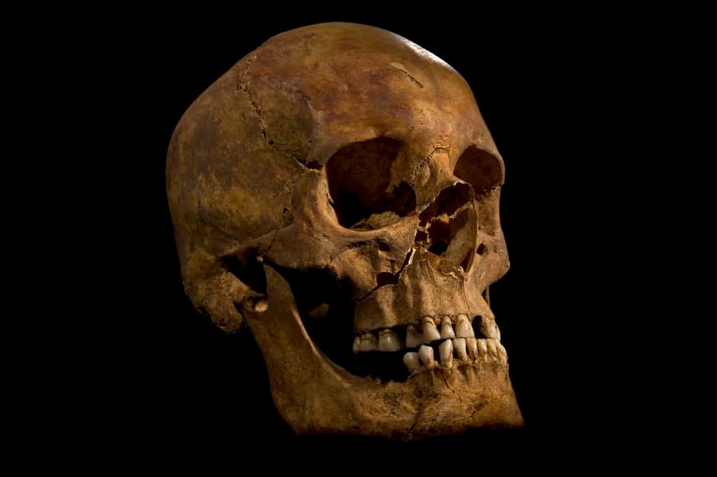 Voici Richard III, roi d'Angleterre, couronné en 1483. Il est mort à Bosworth en 1485, en combattant les troupes levées par Henri Tudor, fraîchement débarqué de Bretagne. Les marques de coups font partie des indices qui ont permis d'authentifier le squelette du souverain. © Université de Leicester