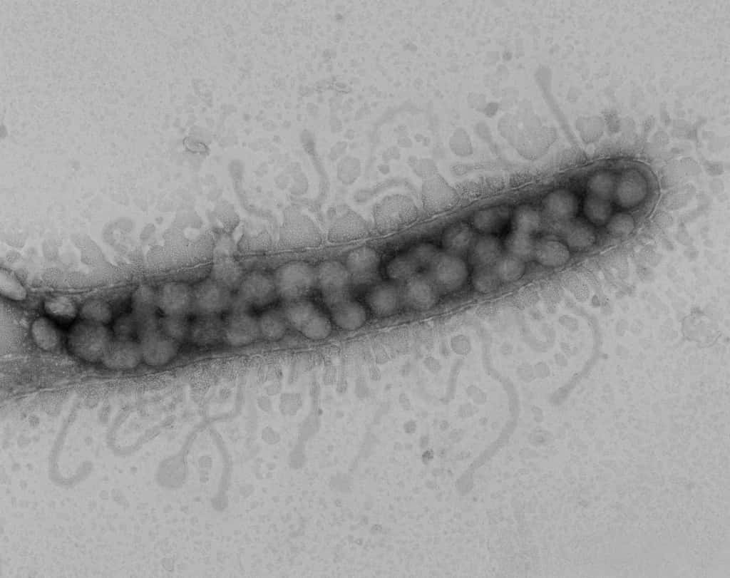 Cette bactérie océanique SAR11 a été infectée par des virus pélagiphages (ils correspondent aux boules situées à l'intérieur du micro-organisme). © <em>Oregon State University</em>