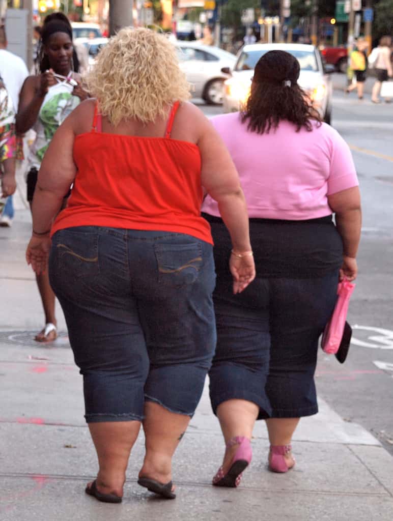 L'obésité et ses pathologies associées comptent parmi les principales causes de mortalité dans le monde. Les régimes manquant parfois d'efficacité, la chirurgie bariatrique devient une solution efficace. © Colros, Flickr, cc by sa 2.0