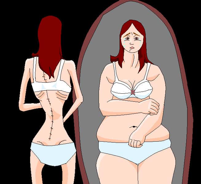 Des études l'ont montré : les personnes atteintes d'anorexie mentale ne se voient pas telles qu'elles sont. Lorsqu'elles se regardent dans le miroir, elles se perçoivent plus grosses qu'elles ne sont le réellement. © Luaxan, deviantart.com, cc by 3.0
