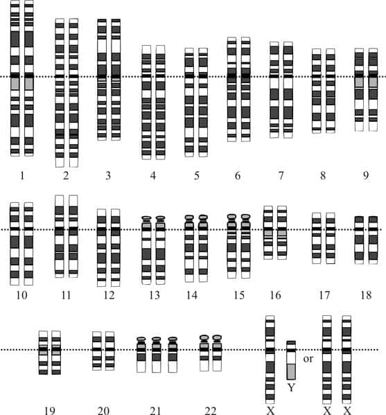 Schéma d'un caryotype d'une personne atteinte de trisomie 21. Le caryotype est l'arrangement des chromosomes par taille et par paires. © <em>Human Genome Project</em>, Wikimedia Commons, cc by sa 3.0