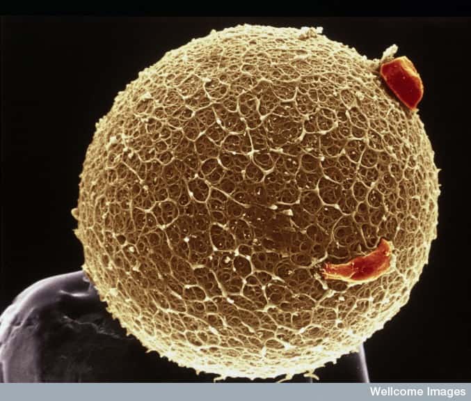 Cet embryon humain, vu en fausses couleurs au microscope électronique à balayage, pourra-t-il être utilisé à des fins scientifiques ? © Yorgos Nikas, Wellcome Images, Flickr, cc by nc nd 2.0