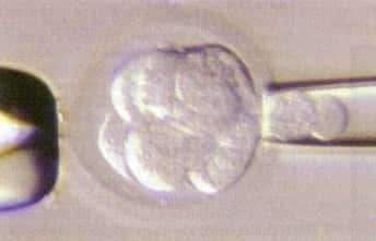 <br />Prélèvement d'une cellule embryonnaire, au cours d'un Diagnostic Préimplantatoire, afin d'en faire l'analyse génétique<br />&copy; The Institute for Reproductive  Medicine and Science of St.Barnabas, Etats-Unis