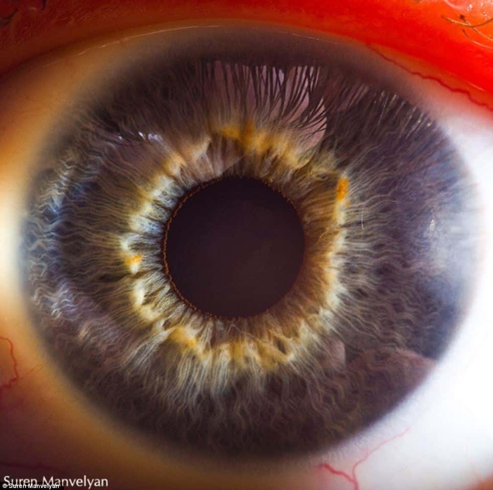 Les personnes aux yeux bleus possèdent peu de mélanine dans la partie antérieure de l'œil et sont plus sensibles au Soleil. © Suren Manvelyan