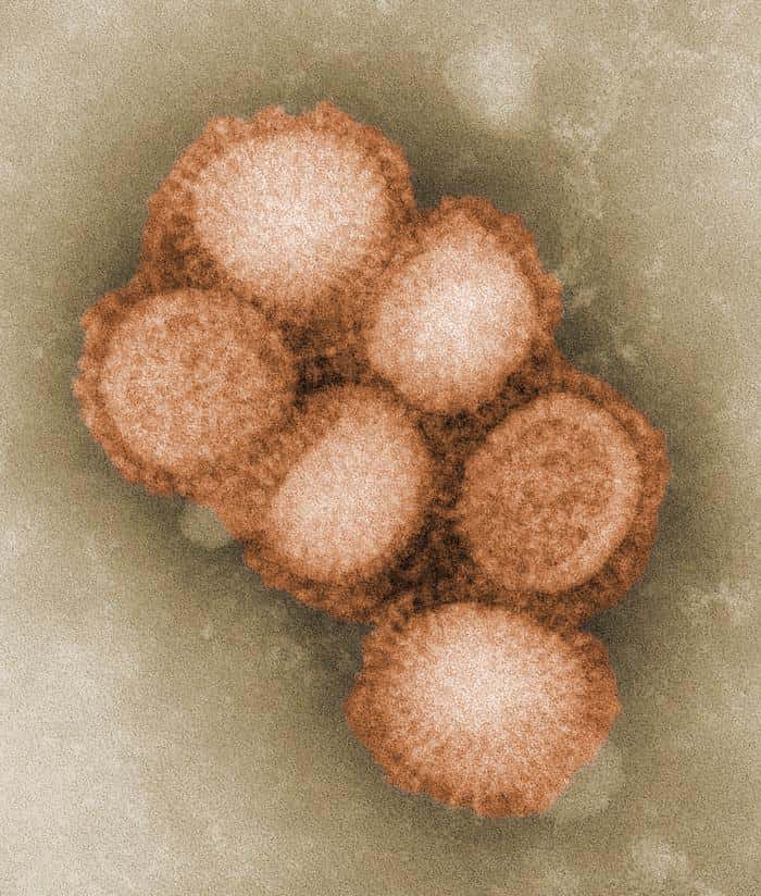 Un vaccin a été développé contre le virus de la grippe A (H1N1). Ce dernier est original, car il combine des fragments du virus des grippes porcine, aviaire et humaine. Il est très contagieux, mais son taux de mortalité reste malgré tout assez faible. © C. S. Goldsmith, A. Balish, CDC, DP