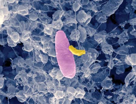 Cette image prise au microscope électronique à balayage révèle <em>Micavibrio aeruginosavorus</em> (en jaune) s'en prenant à la bactérie <em>Pseudomonas aeruginosa</em> (en rose). La proie ne peut échapper aux griffes du prédateur. Cette propriété pourrait être exploitée pour soigner des infections humaines. © Université de médecine et d'odontologie du New Jersey
