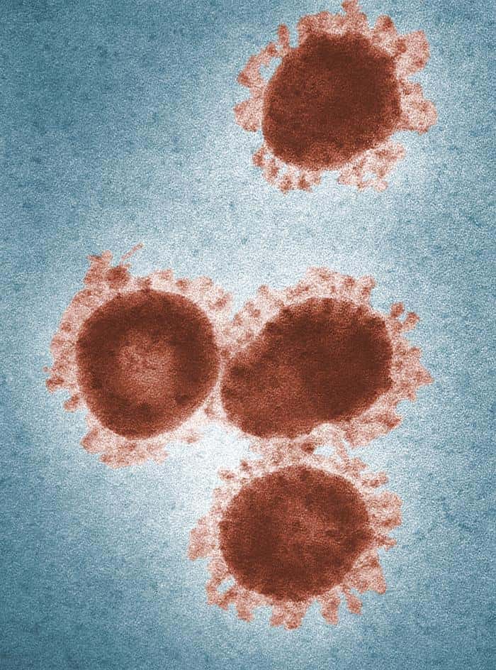 Les coronavirus, comme ceux à l'image, forment un genre de virus surmonté d'une sorte de couronne, qui leur vaut leur nom. NCoV est le dernier né de cette famille, mais ne le sera plus un jour prochain. Le « N » de son nom, pour « nouveau », deviendra donc obsolète. Ainsi, il change de nom pour devenir MERS-CoV. © Fred Murphy, Sylvia Whitfield, CDC, DP