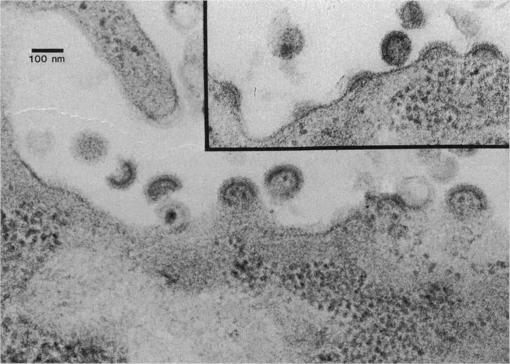 Image de microscopie électronique à transmission provenant de la première publication ayant mis en évidence le VIH, appelé à cette époque LAV, pour <em>lymphadenopathy associated virus</em>.<em> </em>© Barré-Sinoussi<em> et al.</em>,<em> Science</em>