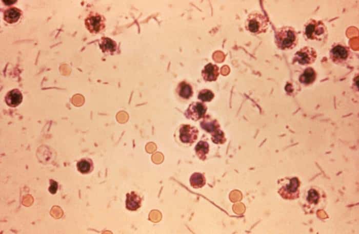 Photographie au microscope de bactéries <em>Shigella dysentariae </em>(les bâtonnets). Ce sont des entérobactéries rencontrées exclusivement chez l’Homme. Le nom <em>Shigella</em> vient du bactériologiste japonais Kiyoshi Shiga, à l’origine de leur découverte. © Wikimedia Commons, CDC, DP