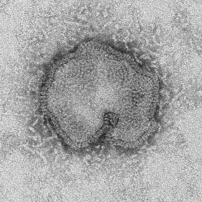 Le virus de la grippe A(H7N9), vu ici sous microscopie électronique à transmission, est capable de muter rapidement et de devenir résistant aux traitements de la grippe. Avec un taux de mortalité de 27,5 % à l'heure actuelle, le risque d'une catastrophe sanitaire mondiale n'est pas si loin. © C. Goldsmith, CDC, DP