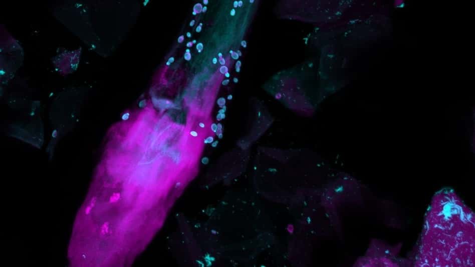 Des cellules fongiques (en bleu clair), et des bactéries (en rose) entourent un poil humain. Image obtenue par microscope à fluorescence. © NHGRI