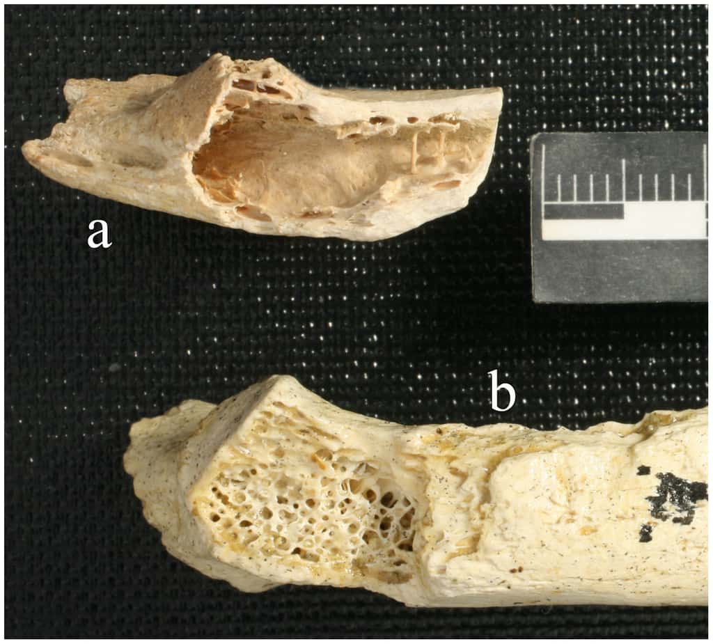 Morceaux de côtes d'Homme de Néandertal. Celui du dessus (a) présente un creux en son centre, ce qui a conduit les auteurs à l'analyser plus en détail. Les résultats d'imagerie suggèrent que cet os aurait contenu une tumeur bénigne. © Monge <em>et al</em>., <em>Plos One</em>