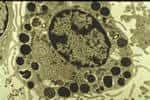 Mastocyte : cette cellule immunitaire contenant de nombreuses granulations dans son cytoplasme a un rôle important dans l'hypersensibilité immédiate. Ces granulations libèrent des médiateurs – par exemple l'histamine - au moment de la réaction allergique<br>© David, B. / Institut Pasteur