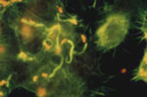 Motilité intracellulaire de la bactérie Shigella. Celle-ci envahit et détruit la muqueuse intestinale du colon provoquant une dysentrie. Elle se déplace dans la cellule infectée et se propage dans les cellules voisines en fabriquant une queue de comète formée d'actine polymérisée.&copy; J.P.Sansonetti/ Inserm 
