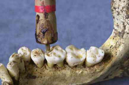 Reconstitution par les archéologues du travail d'une dent, <br />comme pratiqué au néolithique <br />(Crédits : Roberto Macchiarelli, Université de Poitiers) 