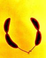  Les bactéries Caulobacter crescentus se fixent sur les objets solides à l'aide de leur longue queue<br /> (Crédits : PNAS)
