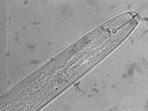 <br /><em>Radopholus similis</em>, nématode parasite du bananier, photo prise au microscope optique, grossissement x100.<br />&copy; IRD - Patrick Quenehervé 