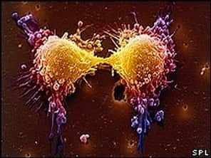 Généralement, les cellules cancéreuses continuent à se diviser car le processus de suicide cellulaire ne s'opère pas Grâce à la PAC-1, cela pourrait bientôt changer... <br />(Crédits : SPL)