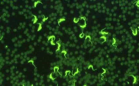 Résultat d'un test positif en immunofluorescence indirecte. Les trypanosomes (souche entretenue en laboratoire) sont ici rendus fluorescents. © Gérard Duvallet