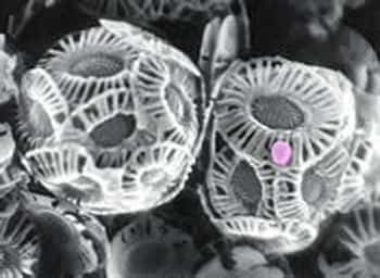 Des algues <em>Emiliania huxleyi</em> observées au microscope électronique à balayage, attaquées par un virus EhVs (coloré artificiellement en rose). Source <em>Commons</em>