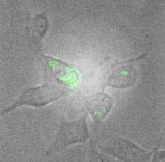 Les nanotubes de carbone signalent leur présence à l'intérieur de cellules de souris par une émission lumineuse. © Dan Heller / MIT